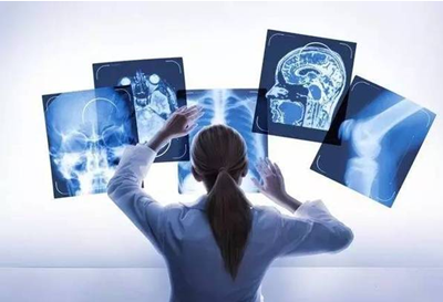 独立第三方医学影像咨询平台汇医慧影完成数千万A轮融资